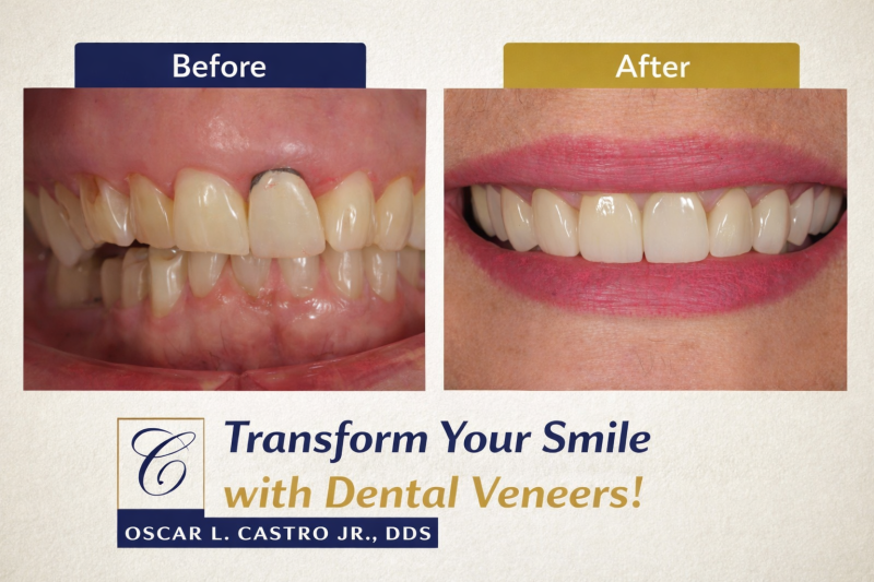 Before and after comparison of a smile transformation using professional dental veneers